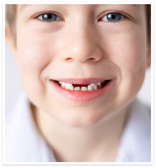Ortodonzia Bambini cosa cura