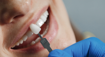 dentista Torino specializzato in estetica dentale